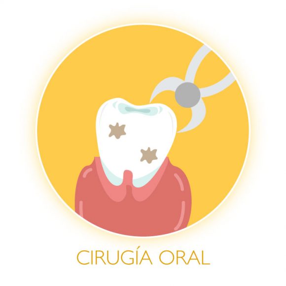 Cirugía Oral
