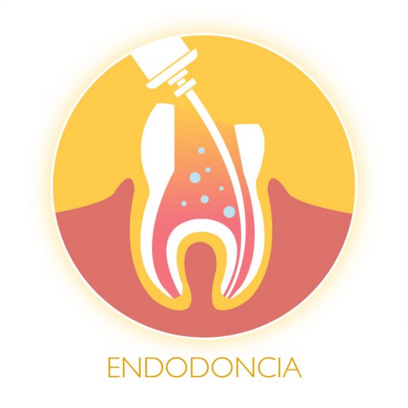 Endodoncia