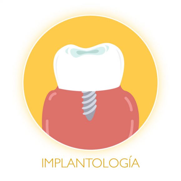 Implantología