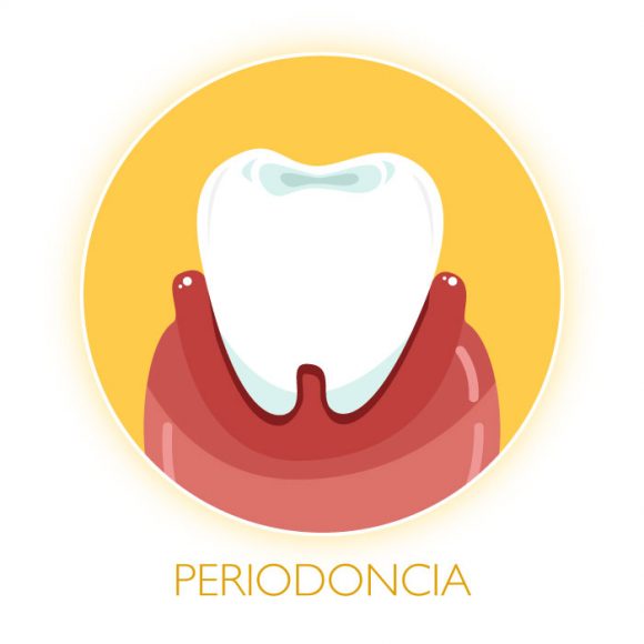 Periodoncia