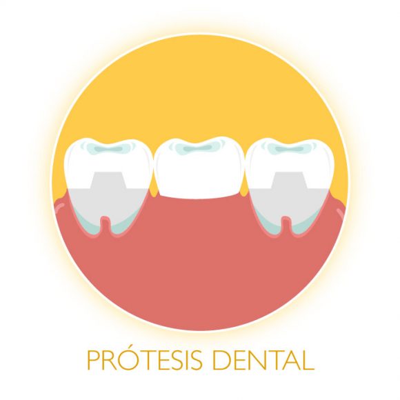 Prótesis Dental